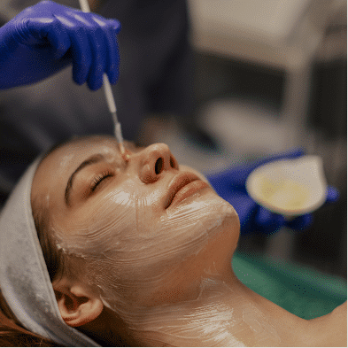 Chemical Peels@1.2-3 Chemical Peels@1.2 3